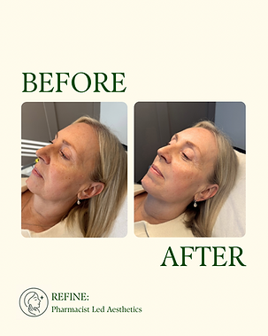 Lucy pearce mpharm pgdip ip.png