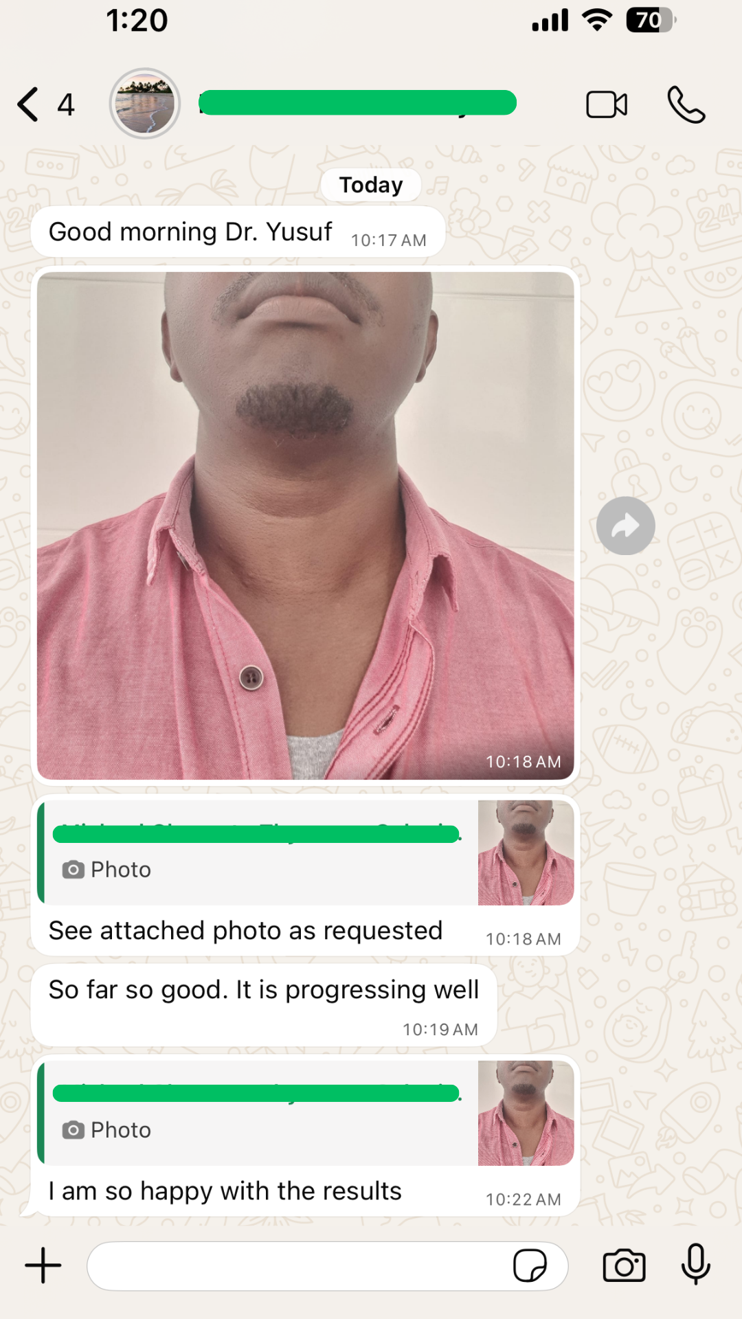 WhatsApp message from a patient describing how happy he is with the results after thyroid 