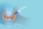 Thyroid microwave ablation in kenya