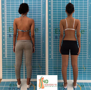 COLETE 3D / COLETE S4D