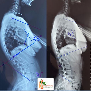 COLETE 3D / COLETE S4D