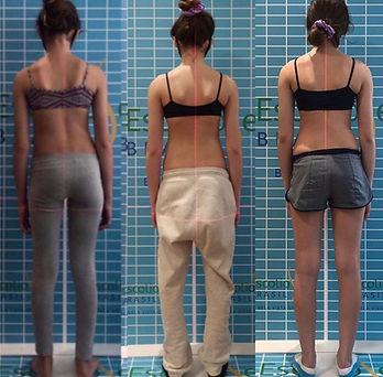 COLETE 3D / COLETE S4D