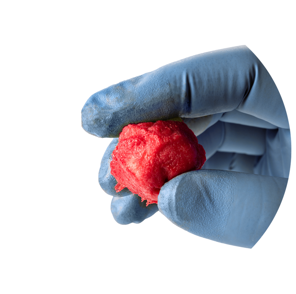 Prime HD Hydrated Cortical Matrix held in gloved hand