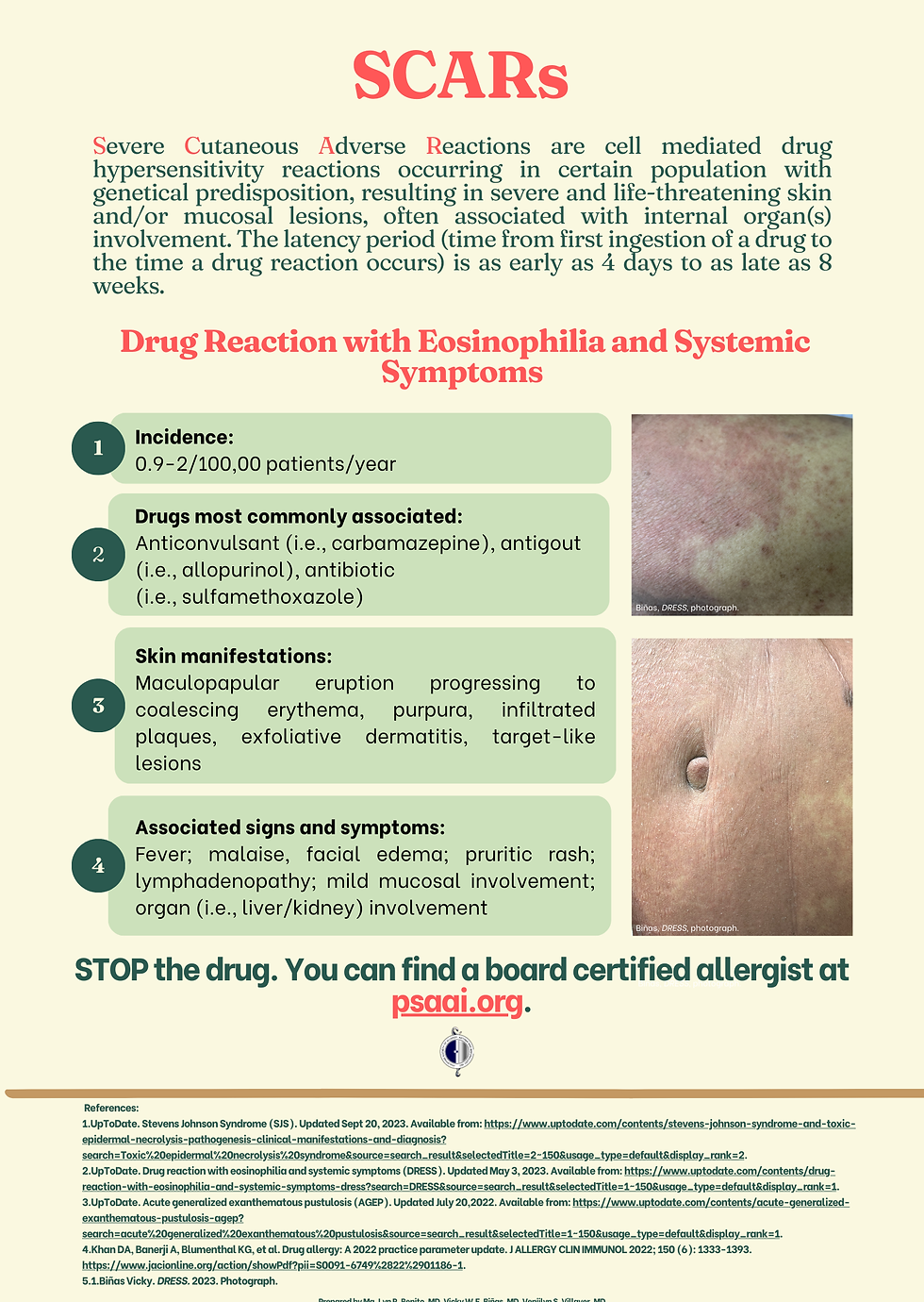 Severe Cutaneous-Drug Reaction with Eosinophilia.png