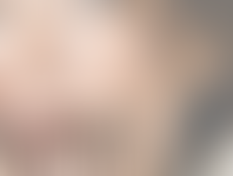 Healthy Skin Equals Longer-Lasting Injectables