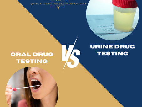 Choosing Between Oral and Urine Drug Testing in Mesa, AZ