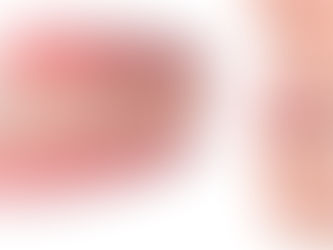 ¿POR QUÉ LOS DIENTES TORCIDOS TE PUEDEN CAUSAR PROBLEMAS?