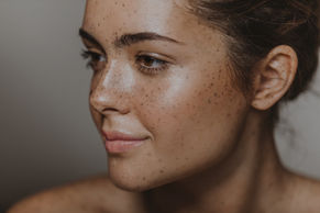 Woman with freckles smiles, natural beauty, portrait, skin care, close up