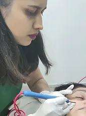 wart removal.webp