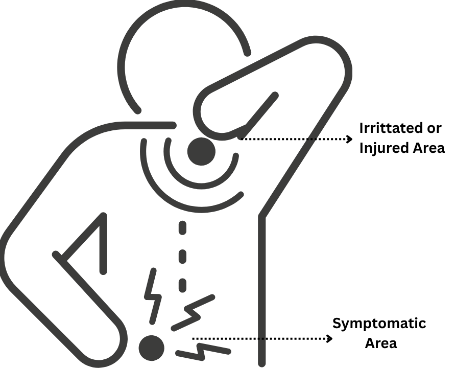 pain referral