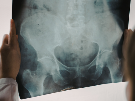 Finding Balance in Your Hips