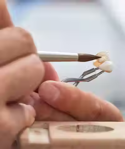 歯科技工工程