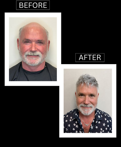 BEFORE & AFTER Ronnie B..png