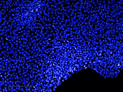 DAPI-TRA-1-81-sylnea-ips-1.png