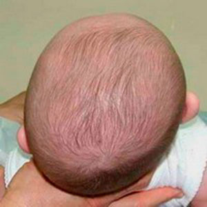 "Pas d'ostéopathie pour vos enfants avant 2 ans !"