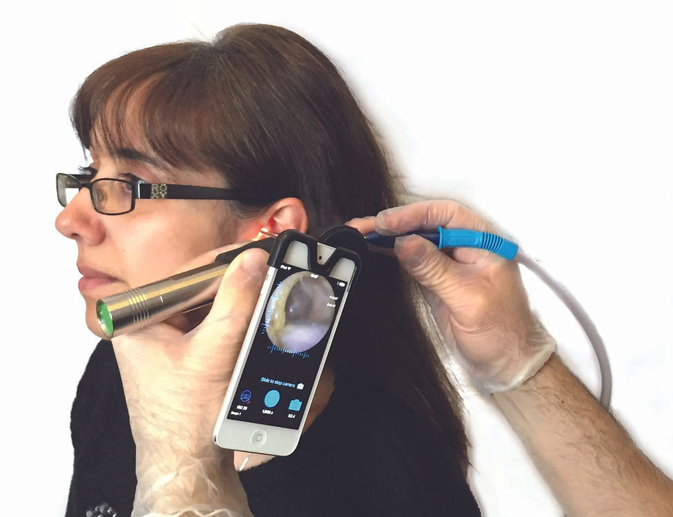 woman having an Endoscopy done