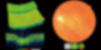 OCT scan showing macula