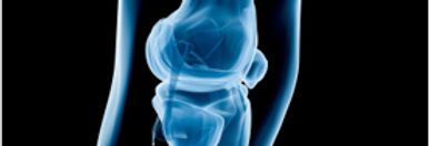 l_im_knee_01.jpg