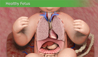 Pediatric-CDH-Healthy-Fetus.jpeg