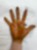 excessive sweating hand antiwrinkle.JPG