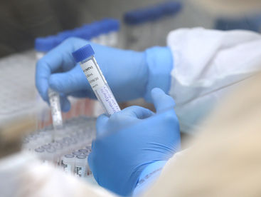 Ponta Grossa já registrou 61 casos da H3N2