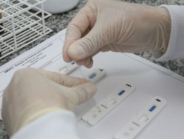 Profissionais da Saúde e Segurança Pública de PG farão teste rápido para o novo coronavírus
