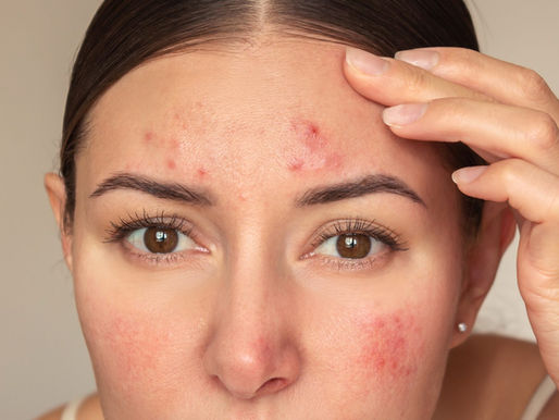 😵💫 Here's How Stress Shows Up Physically