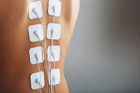 Electric Stimulation & Interferential Therapy (Hill IFC)