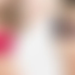 果凍矽膠開放 乳房重建優先