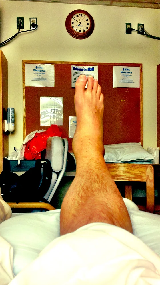 Fracturedheels Com My Recovery From Fractured Heels Journey