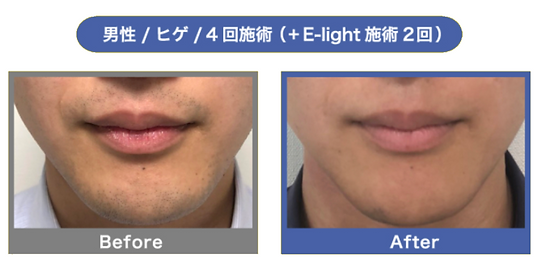 無題36-20210519123748.PNG