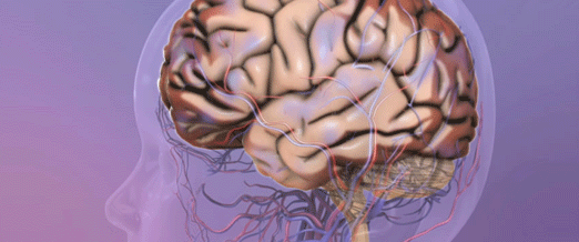 Cerebral palsy
