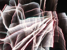 Universal Donor Organs Are Becoming A Reality