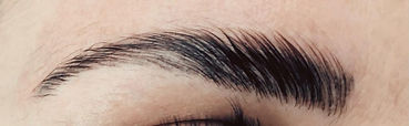 Brow Lift