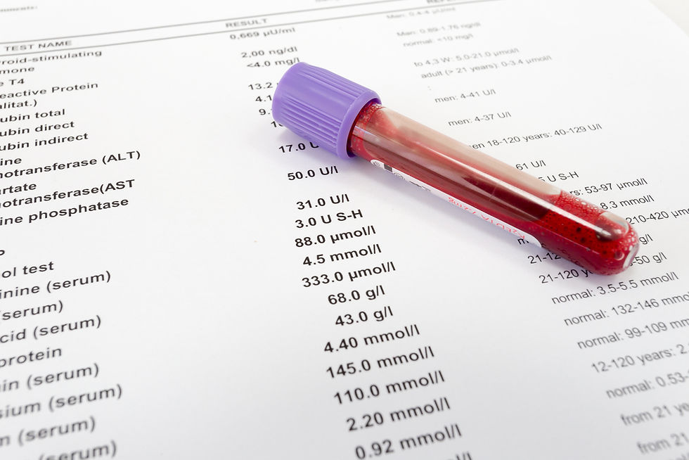 ChatGPT provided easy-to-understand explanations of blood tests.
