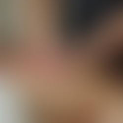 Massage for Back Pain: Techniques, Benefits, and Relief Tips