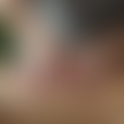 Benefits of Therapeutic Massage for Wellness