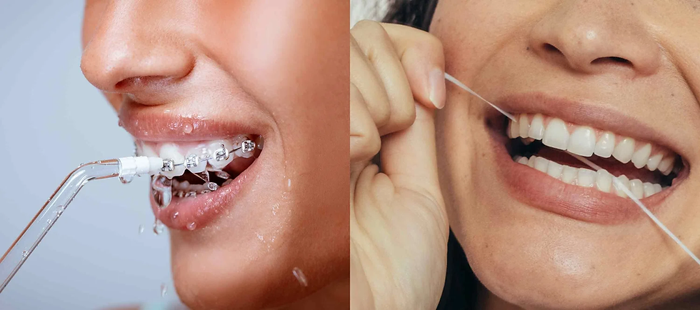 Water flosser VS Flossing : What suits best for you?
