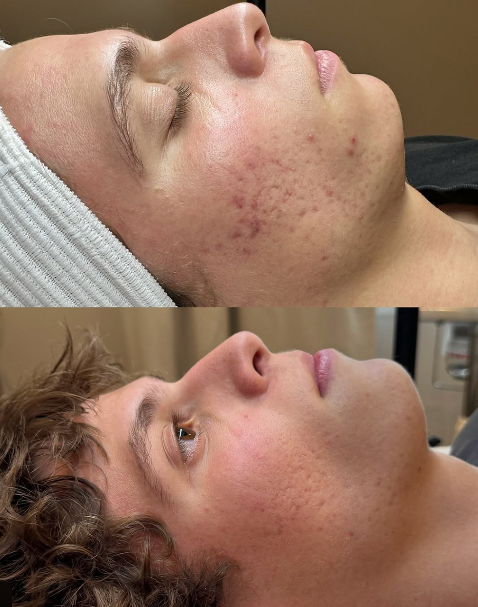 Eye-level view of a skincare professional applying a green sea peel treatment to a client's face