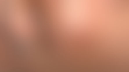 TimeMachine Peel: Why Prep and Adaptability Matter in Skin Treatments