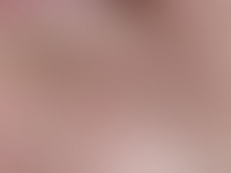 Corthe's Overnight Pimple Fix and Daily Acne Preventer