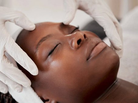 How to Treat Acne in Darker Skin Without Causing Hyperpigmentation