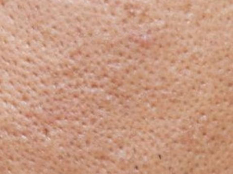 Why Do We Have Large Pores?