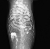 横隔膜ヘルニア