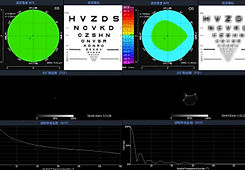 SK7000-Simulador-Lentes-de-Contacto-Corneal-2.jpg