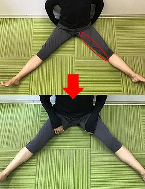 開脚 施術前後2