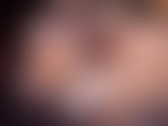 Experten schlagen Alarm: Jedes zweite Pferd ist zu dick!