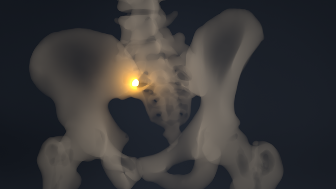 Case_01_1080p_v01_tumour_0534.png