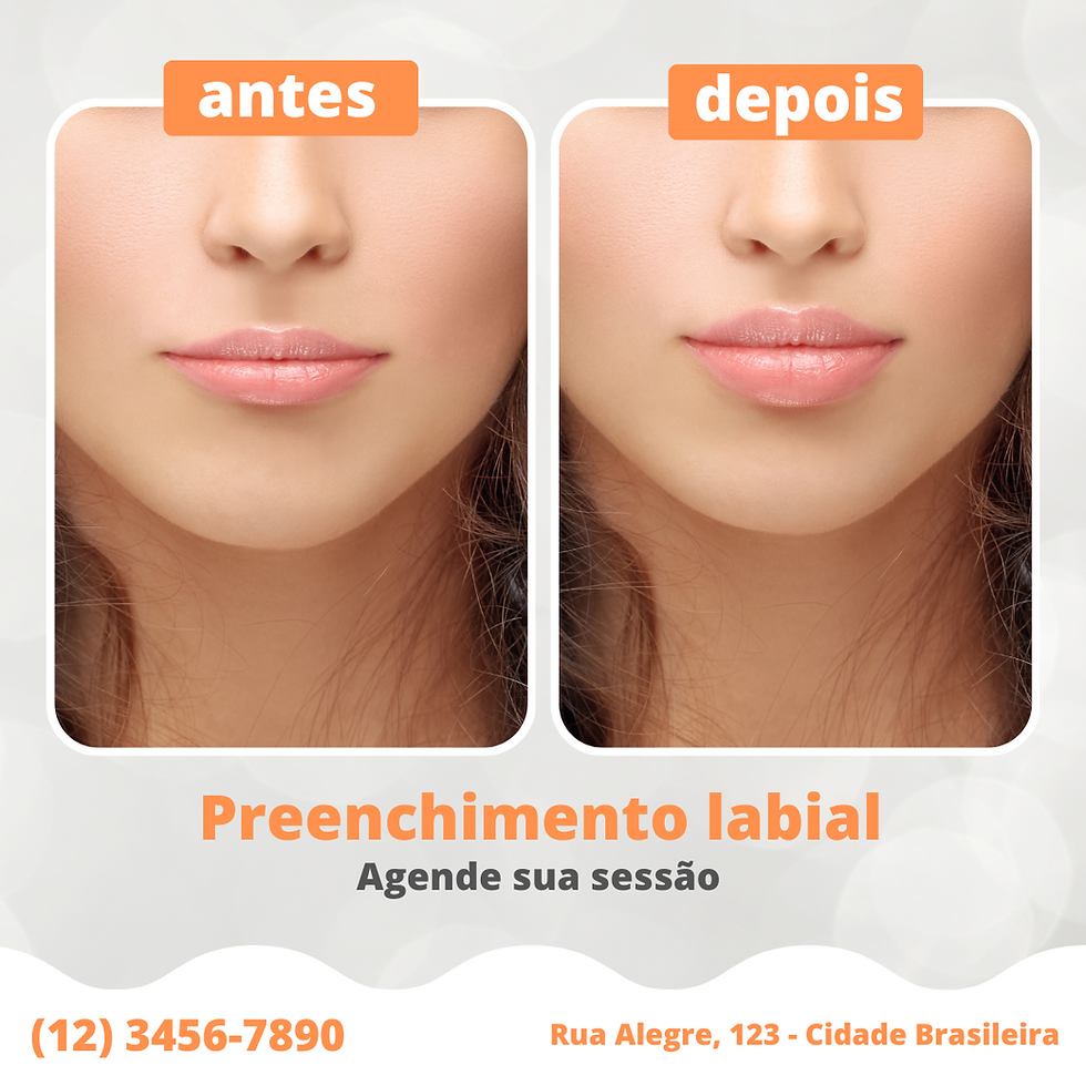 Exemplo de antes e depois
