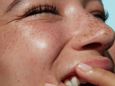 How to Prep (and Care for) Your Skin Before and After a Treatment